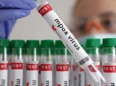 Mpox case detected in Gauteng